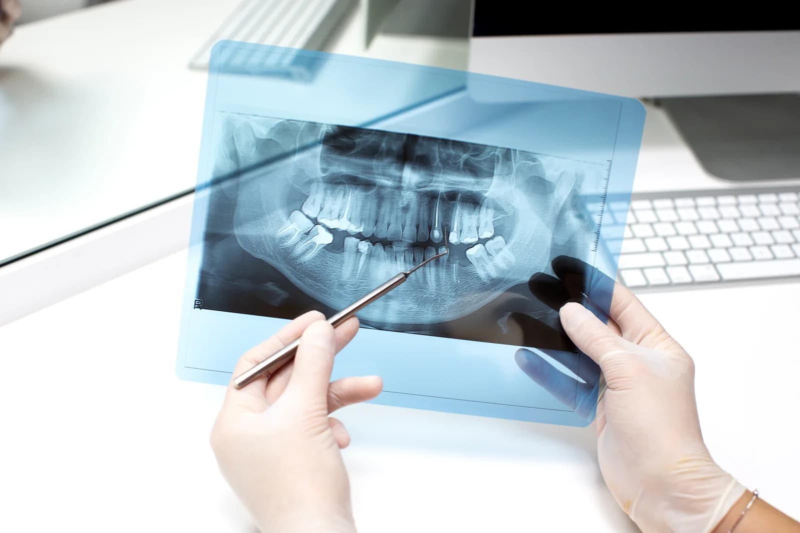 Oral & Maxillofacial Surgery Doctors and Clinics in Jordan — A doctor reviewing a panoramic X-ray of the jaws and teeth — directory of the best Oral & Maxillofacial Surgery doctors in Jordan